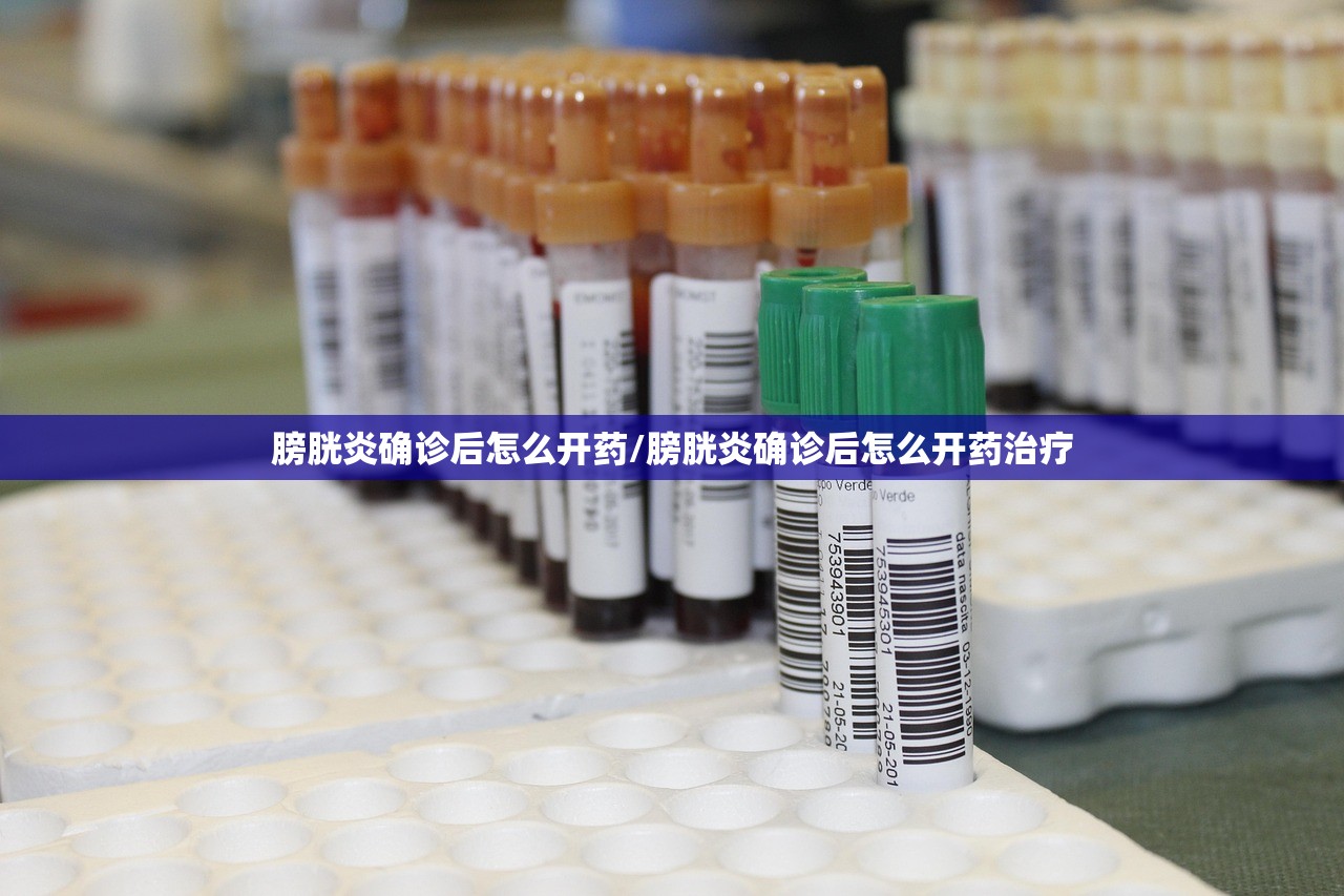 膀胱炎确诊后怎么开药/膀胱炎确诊后怎么开药治疗 膀胱炎确诊后怎么开药/膀胱炎确诊后怎么开药治疗